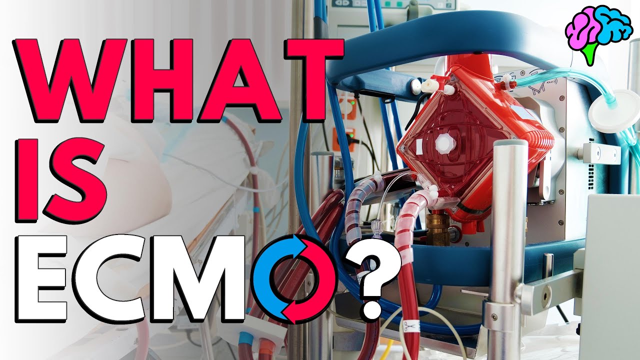 What is ECMO? The basics explained.