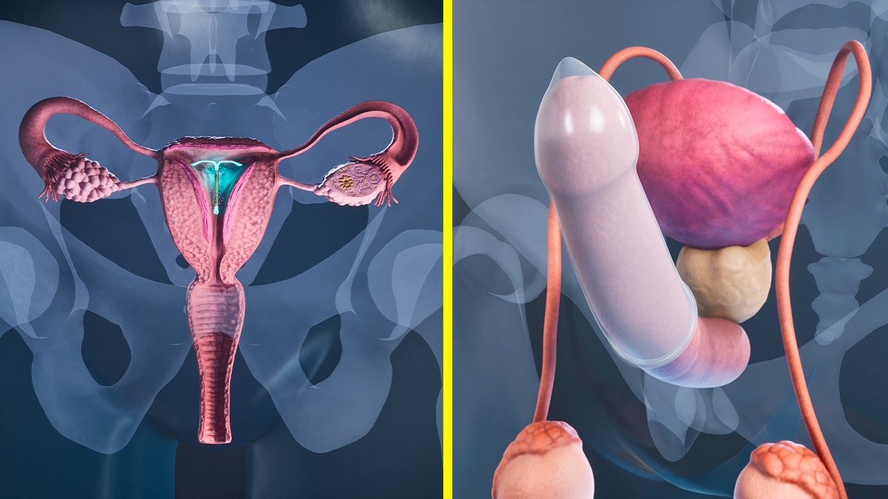 Come funzionano i metodi contraccettivi femminili e maschili e quali sono i più efficaci
