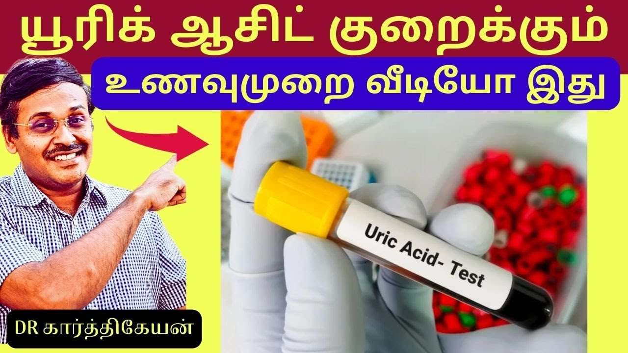 foods to avoid reduce uric acid naturally | home treatment doctor karthikeyan
