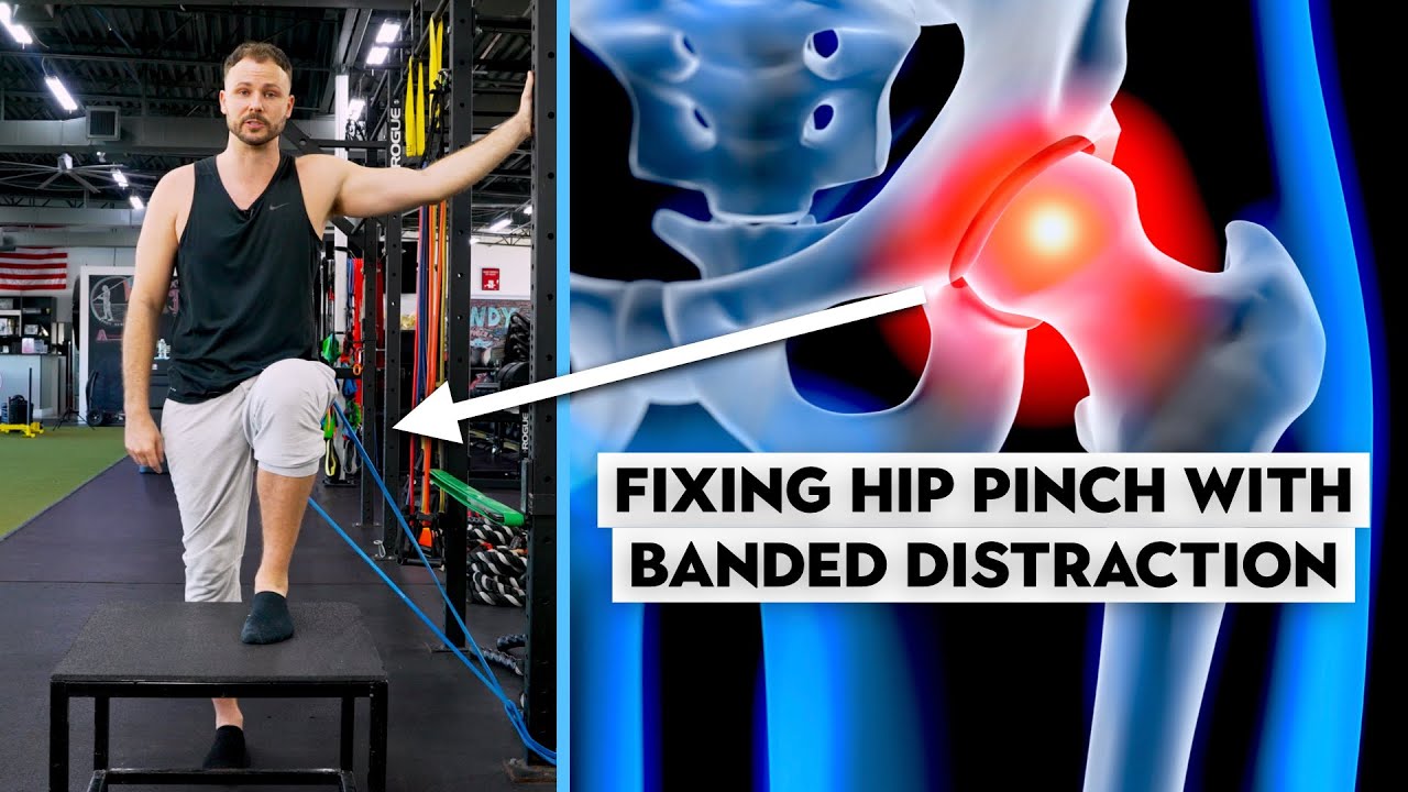Fixing Your Hip Pinch Part 2 (Banded Distraction)