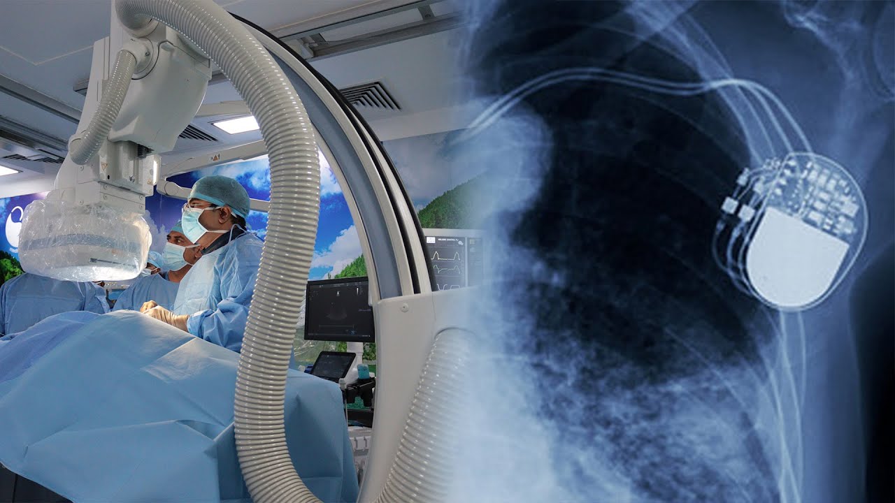 Successful Pacemaker Installation Procedure; Pamela Akelo; Dr. Vijay Sinh Patil