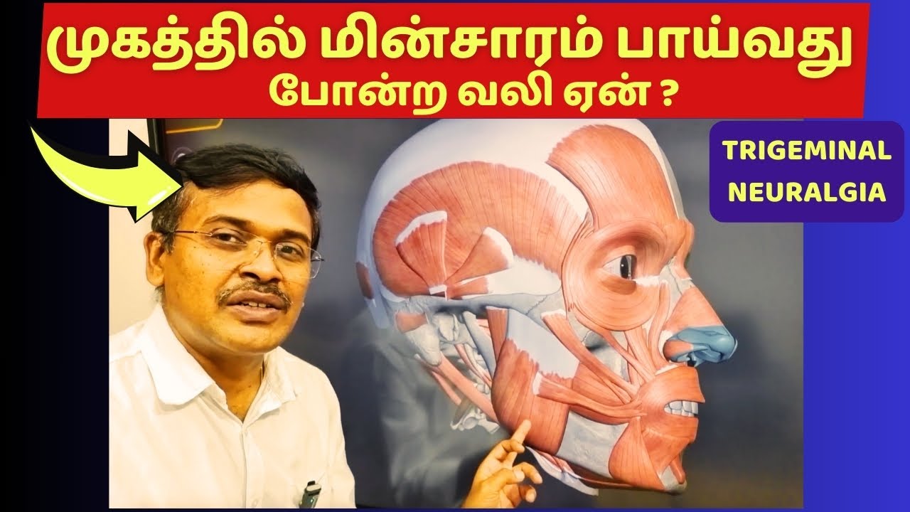 உதட்டின் மேலே மின்சாரம் போன்ற சுர்ரென்ற வலி ஏன் ? | trigeminal neuralgia