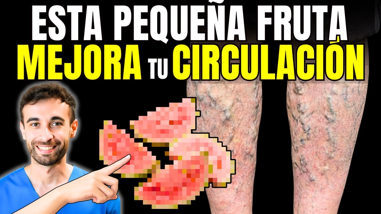 La FRUTA #1 para las VARICES y Arañitas (El Secreto de los Flavonoides)