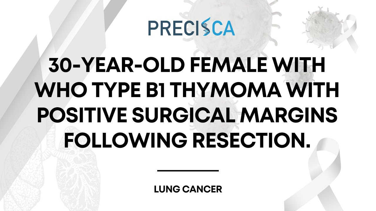 Expert Cancer Panel: WHO type B1 thymoma with positive margins following resection