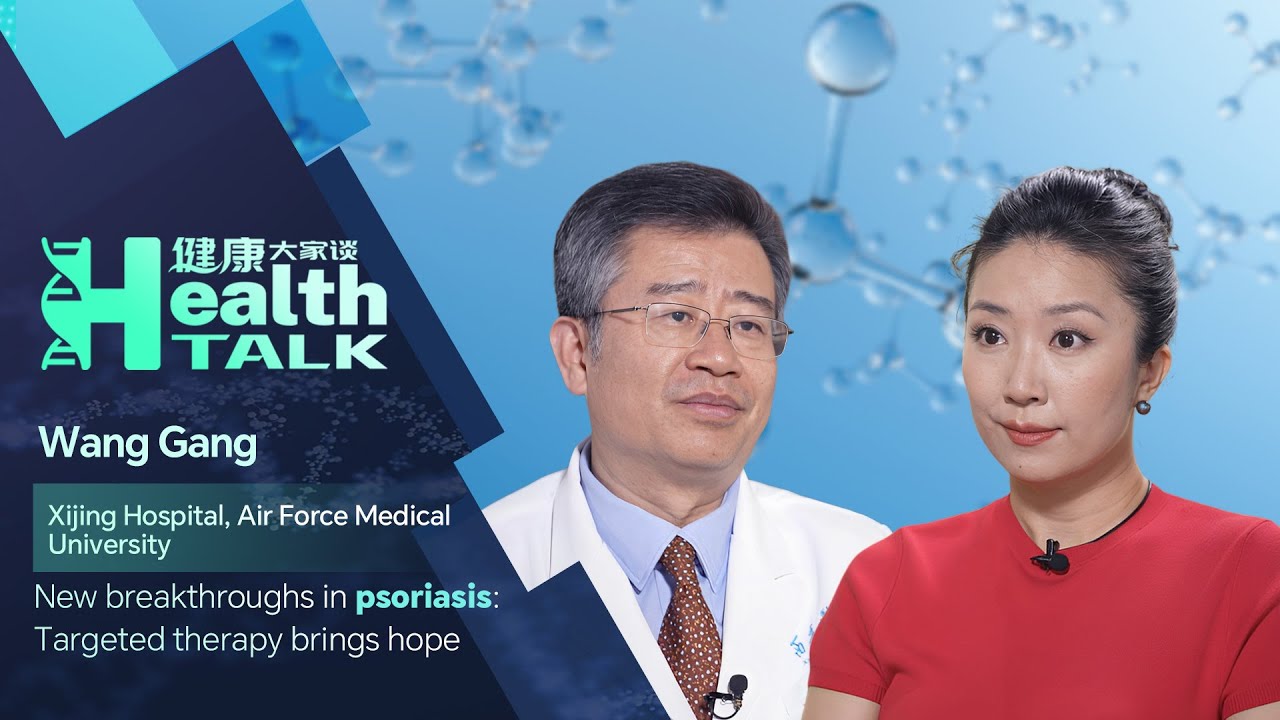 Health Talk: Targeted therapy promises hope for psoriasis treatment