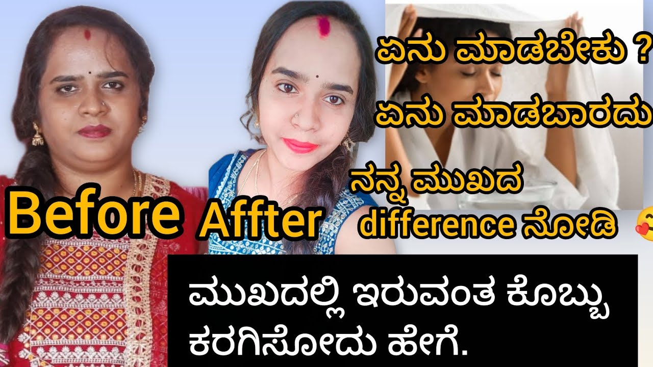 ಮುಖದ ಕೊಬ್ಬು ಕರಗಿಸಲು ಈ ಒಂದು ಕೆಲಸ ಮಾಡಿ, ಸಾಕು, ಕಾಮೆಂಟ್ ಗೆ ಉತ್ತರ. #weightlossjourney #live #reselt #fece