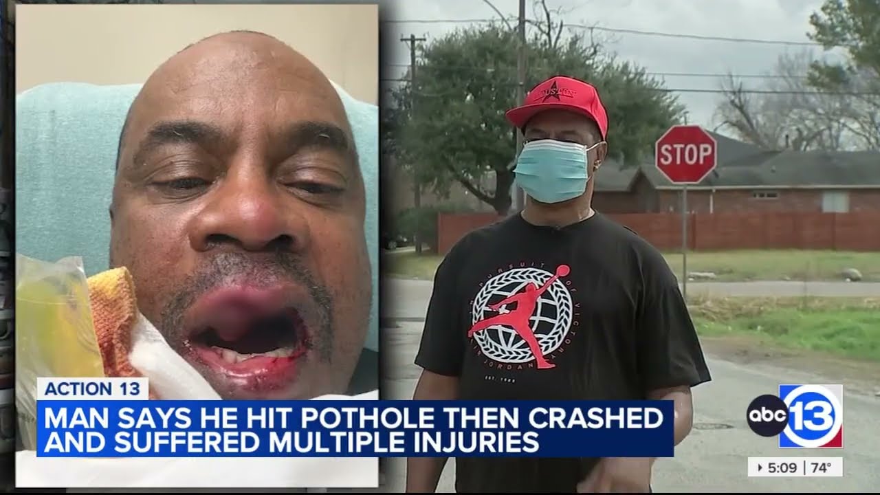 Man says he hit pothole, crashed, and suffered multiple injuries