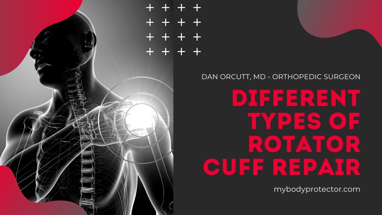 Different Types of Rotator Cuff Repair - Dan Orcutt, MD, Orthopedic Surgeon