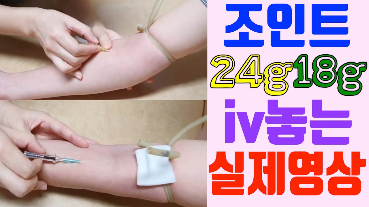 **실패없는 조인트 18g iv, 24g iv 완전 마스터 하세요^^!! / 조인트iv 실패없이 한번에 성공하는 특급비밀~!!