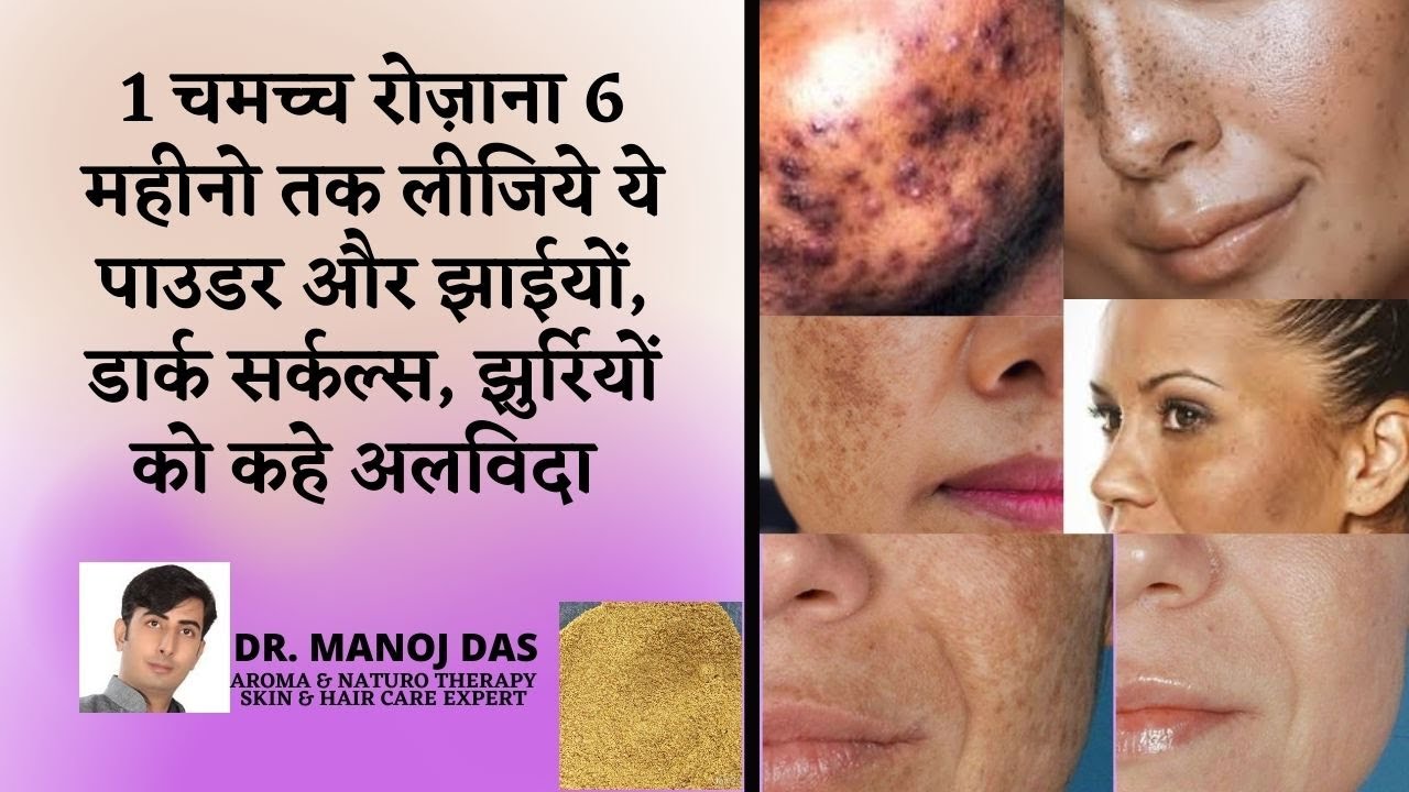 1 चमच्च रोज़ाना 6 महीनो तक लीजिये ये पाउडर और झाईयों, डार्क सर्कल्स, झुर्रियों को कहे । DR. MANOJ DAS