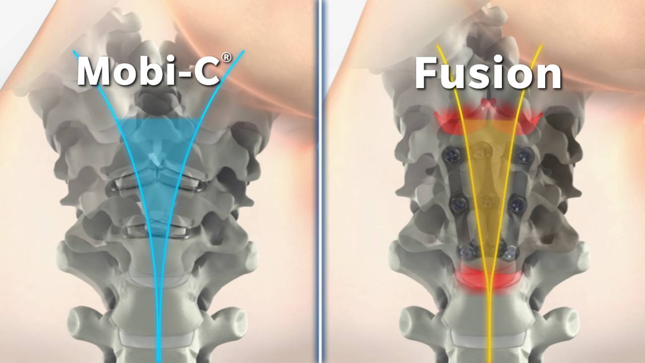 Mobi-C vs Fusion Animation Video