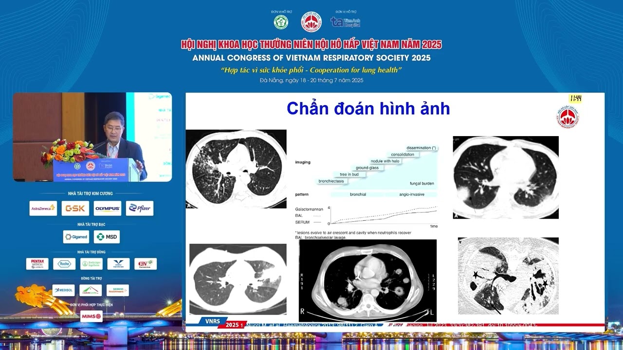 Trần Văn Ngọc - HƯỚNG DẪN CHẨN ĐOÁN NHIỄM NẤM XÂM LẤN