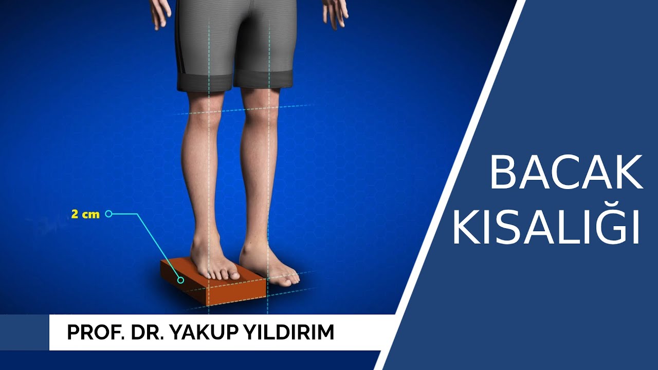 Doğuştan Bacak Kısalığı | Prof. Dr. Yakup YILDIRIM