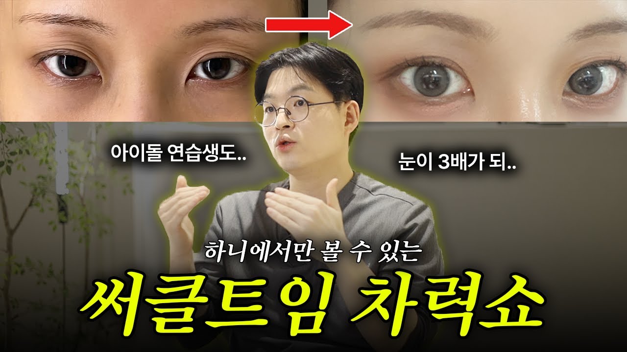 연예인들은 다 이거 받고 눈 커졌대✨눈이 3배가 되는 ＜써클트임 차력쇼＞ 보여줄게💛