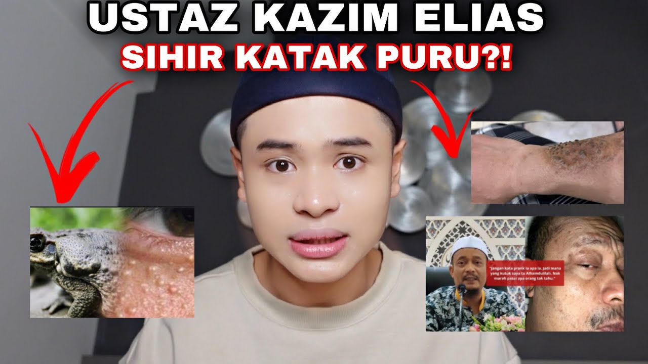 NOURROR❗️| KENA SIHIR / S4NTAU KATAK PURU😱 | SIAPA PANDAI BERUBAT, TOLONG LAH😭‼️