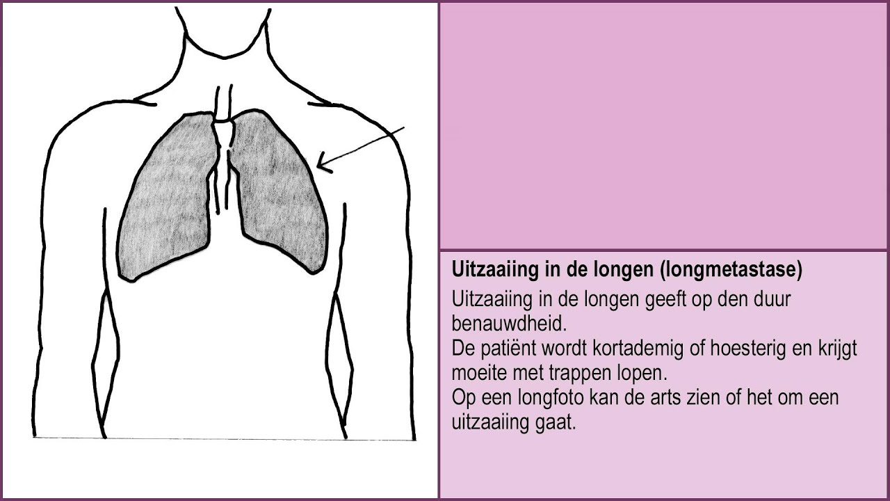 Wat als je niet meer beter wordt? -- Uitzaaiingen in botten, longen, lever, hersenen 2/6