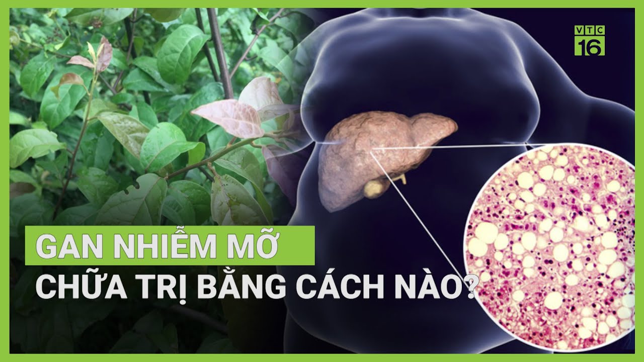 Cây xạ đen có chữa được gan nhiễm mỡ? | VTC16