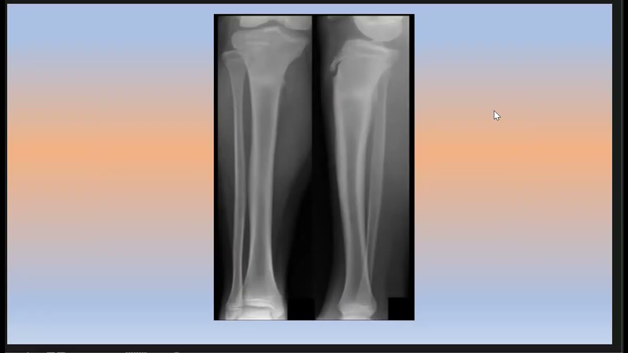 Cases Discussion Part 28