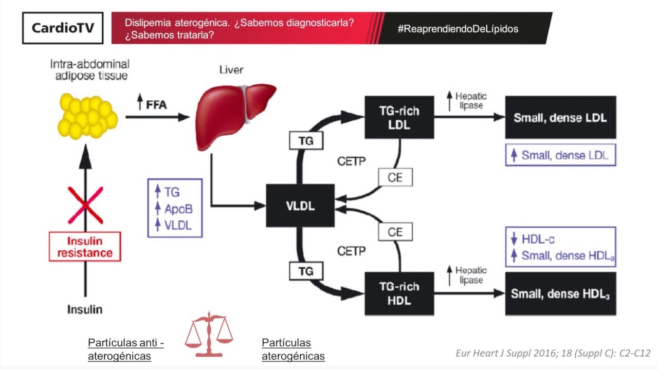 Dislipemia aterogénica. ¿Sabemos diagnosticarla? ¿Sabemos tratarla?