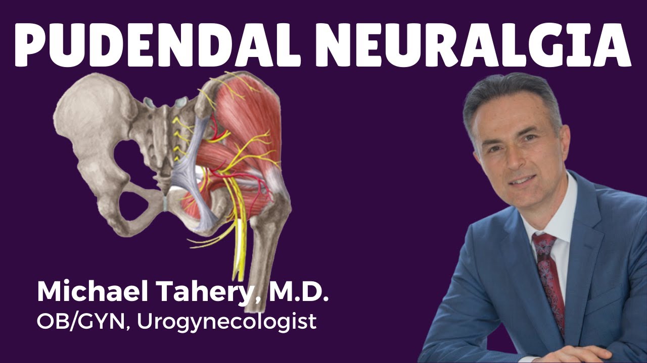 Pudendal Neuralgia Treatment | Los Angeles | Dr Michael Tahery