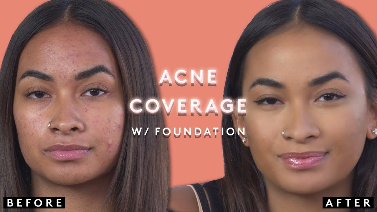 COVERING ACNE WITH FOUNDATION | FENTY BEAUTY