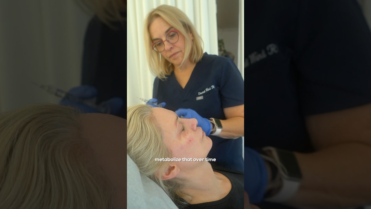 Dermal Filler vs Biostimulators: What&rsquo;s the Difference?