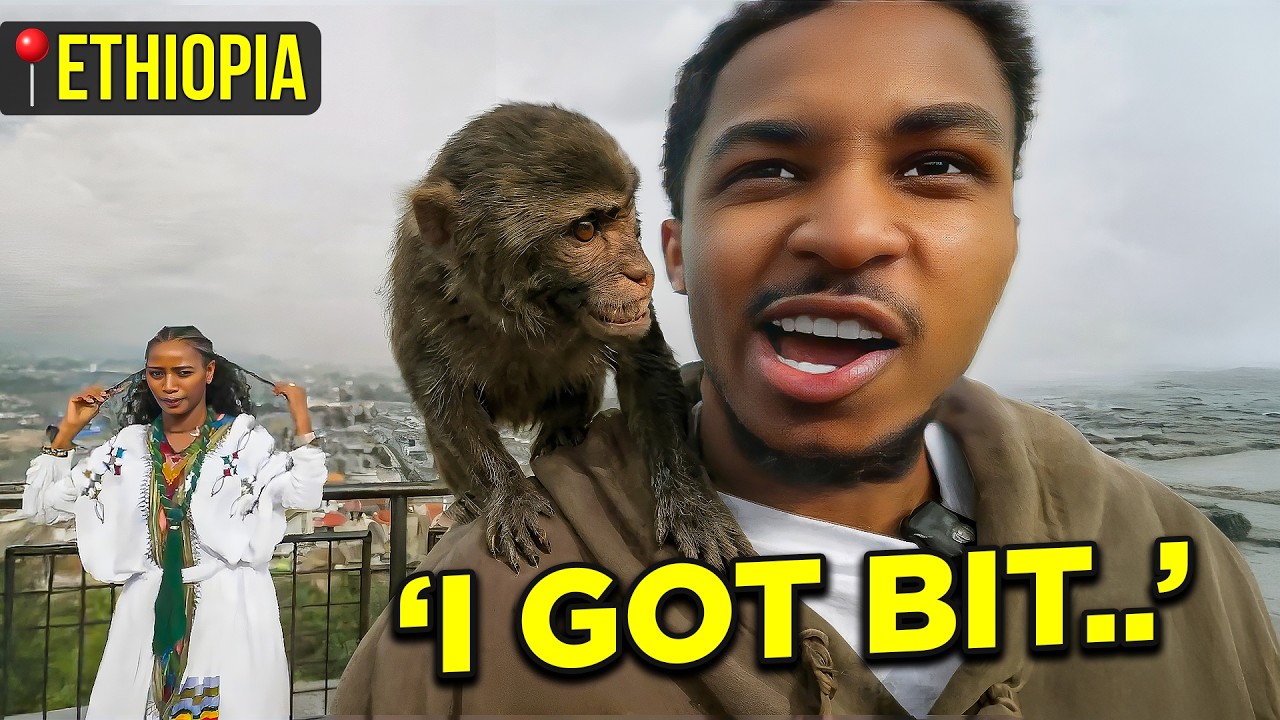 I GOT BIT BY A MONKEY IN ETHIOPIA.. 🐵🇪🇹  *NOT CLICKBAIT*