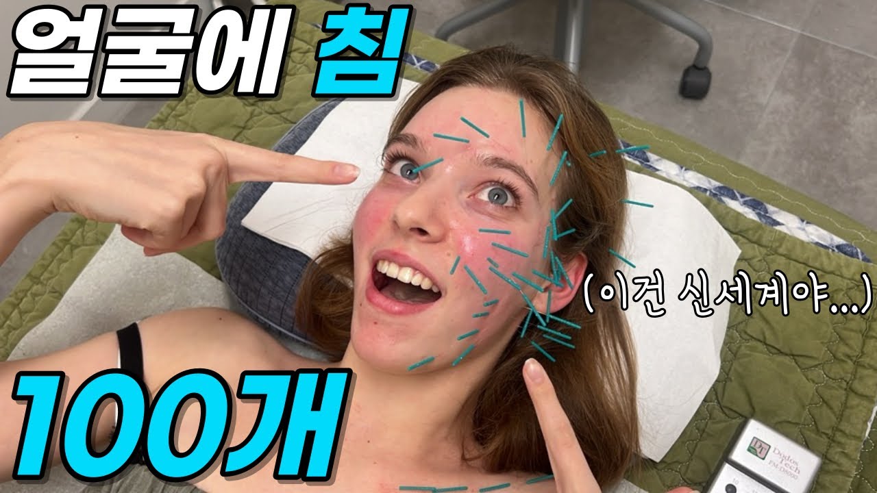 (Eng sub)절대 한의원 안간다던 프랑스 여자친구, 막상 침 맞고 나니 반응이 무섭네요….또 가쟤요ㅋㅋㅋㅋㅋ Foreigner goes Korean medical clinic