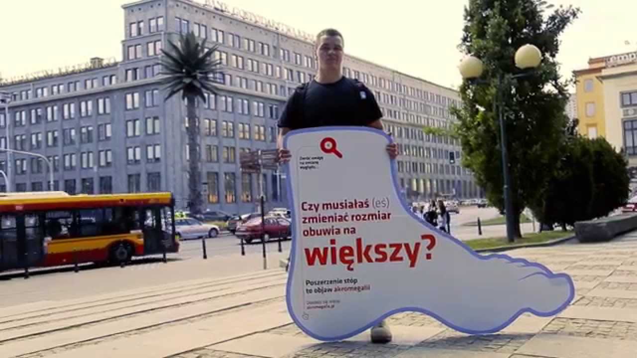 Akromegalia - rzadka, ale charakterystyczna choroba