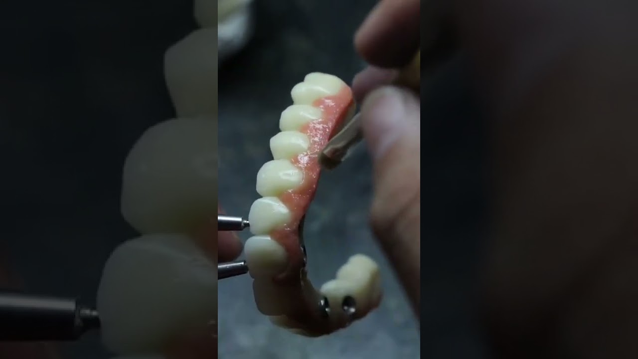 Protocolo de resina. 💥 #odonto #odontologia #dentistry #laboratory #dental #protetico