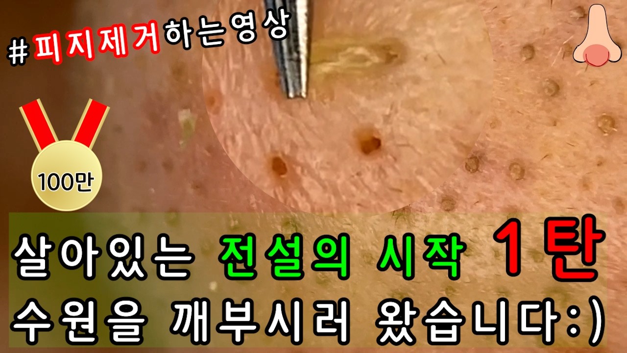 피지 직접 뽑아드렸습니다 _ 피지제거 블랙헤드제거 피지뽑기 _ 경기도 수원에 살아있는 전설을 모시고 피지를 개박살 내주고 왔습니다 1탄