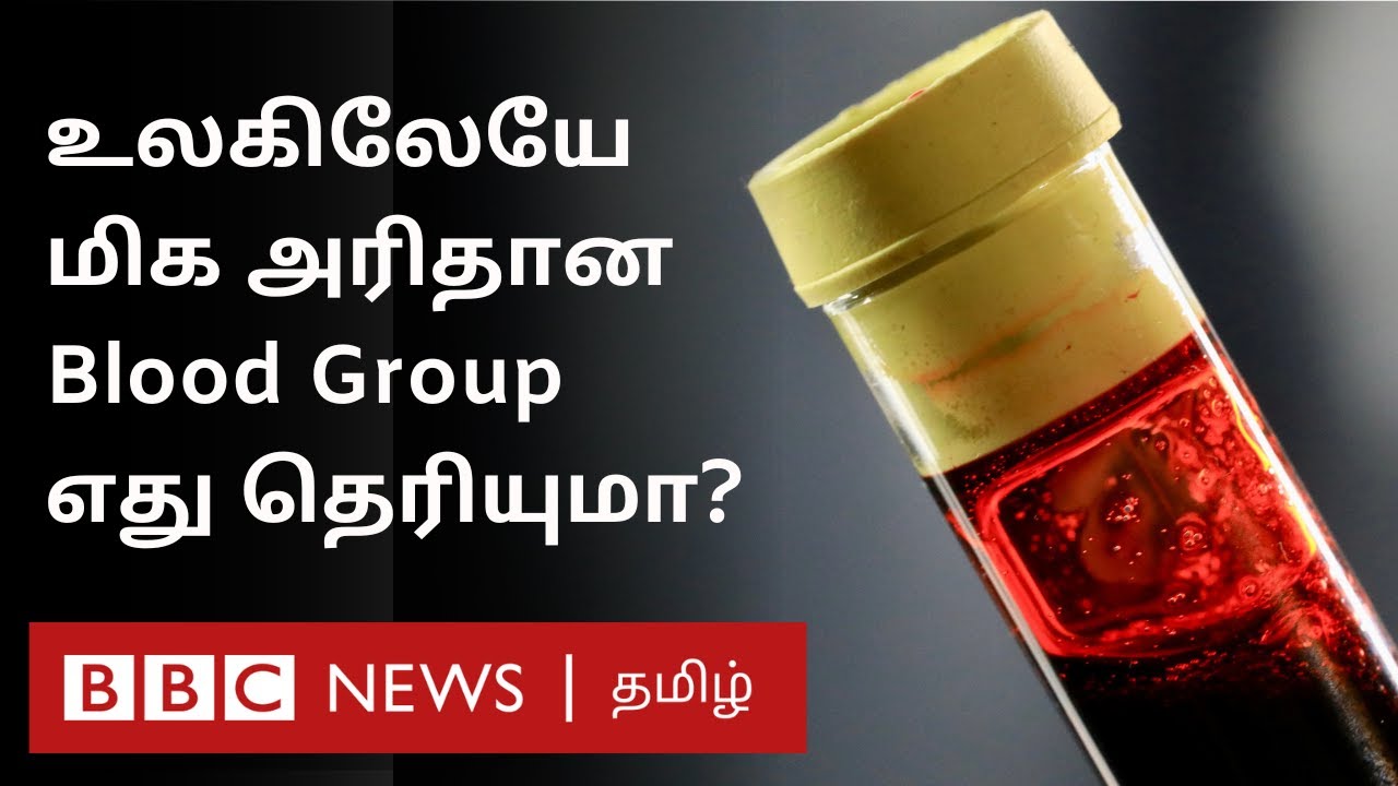 உலகத்திலேயே 50 பேருக்கும் குறைவாக உள்ள Blood Group எது தெரியுமா? | Blood Group Explainer