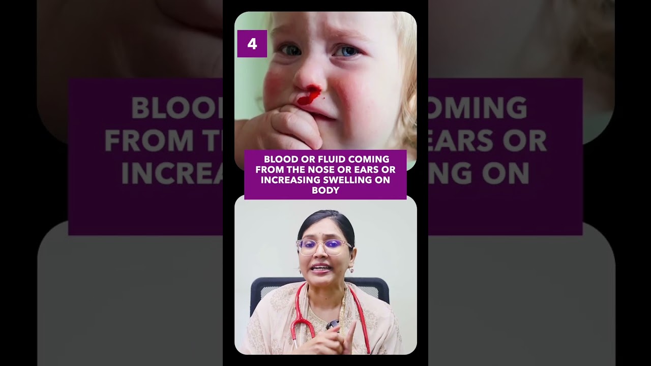 Head injury in baby when to worry? | Dr Anusha Rao #headinjury #babyhealth