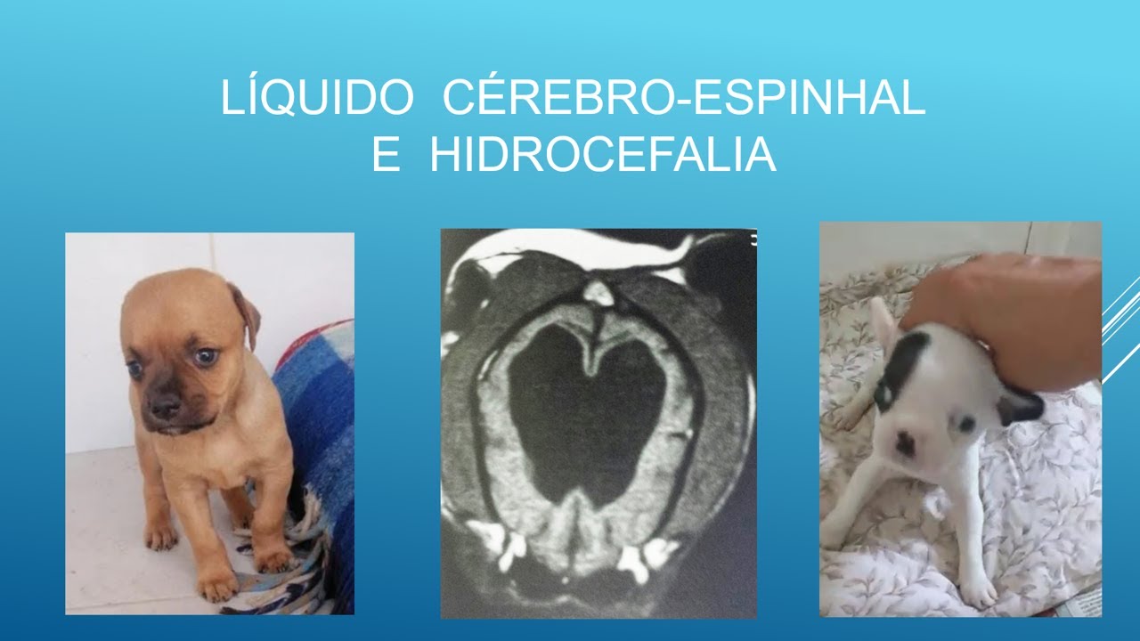 Líquido cérebro-espinhal e hidrocefalia