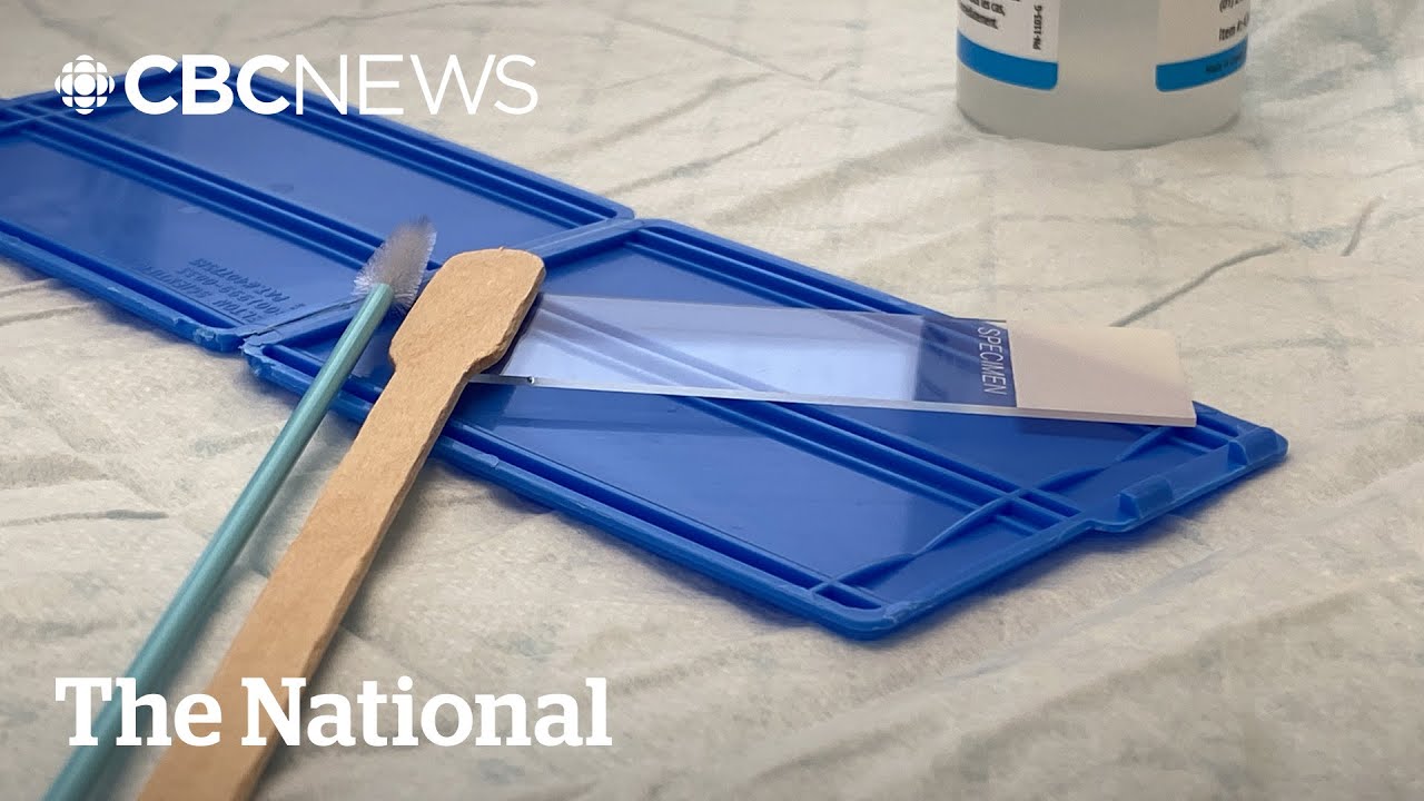 Ontario switches to HPV test for cervical cancer screening