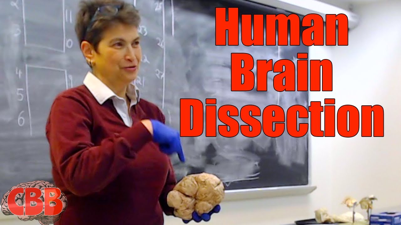 How to dissect a human brain w/Professor Peggy Mason