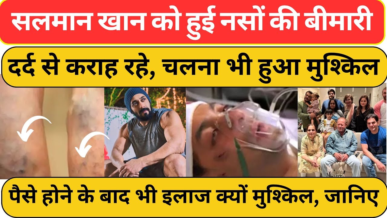 Salman Khan को हुई नसों की ऐसी बीमारी, दर्द से कराहते घूम रहे! Kapil Sharma I Trigeminal Neuralgia