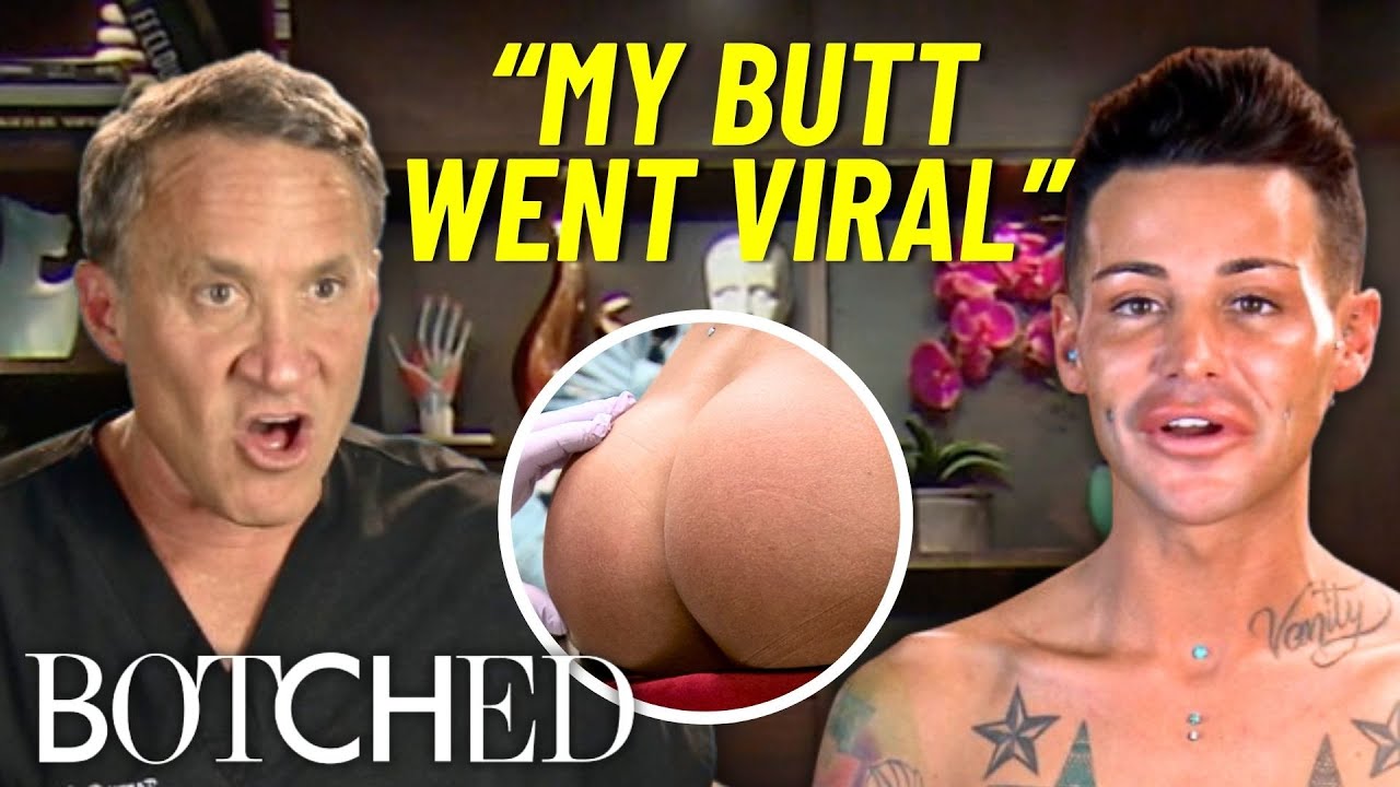 REJECTED By Botched: Joey Spent Over $60,000 On Butt Implants & Plastic Surgery | Botched | E!