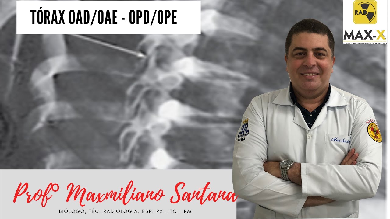 Como aprender sobre as Oblíquas de Tórax (OAD/OAE - OPD/O)PE