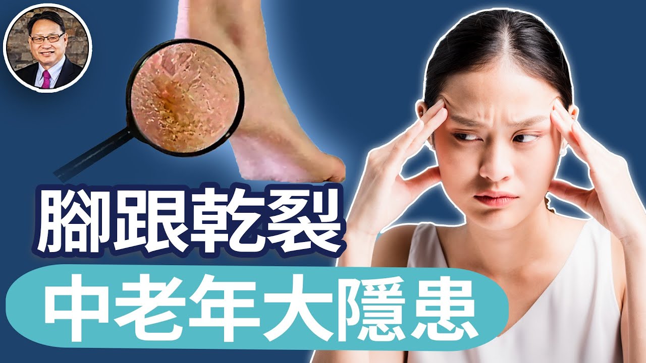 不要輕視腳跟乾裂，可能有大隱患，中老年人雙腳跟乾裂的原因與解決方法｜四維健康