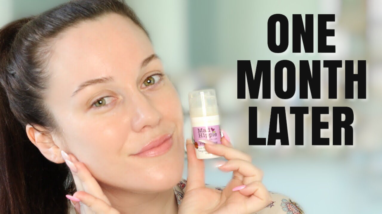 ONE MONTH LATER📆MAD HIPPIE EYE CREAM FOLLOW UP💎⚗💎DOES IT WORK?! MY RESULTS AND EXPERIENCE!