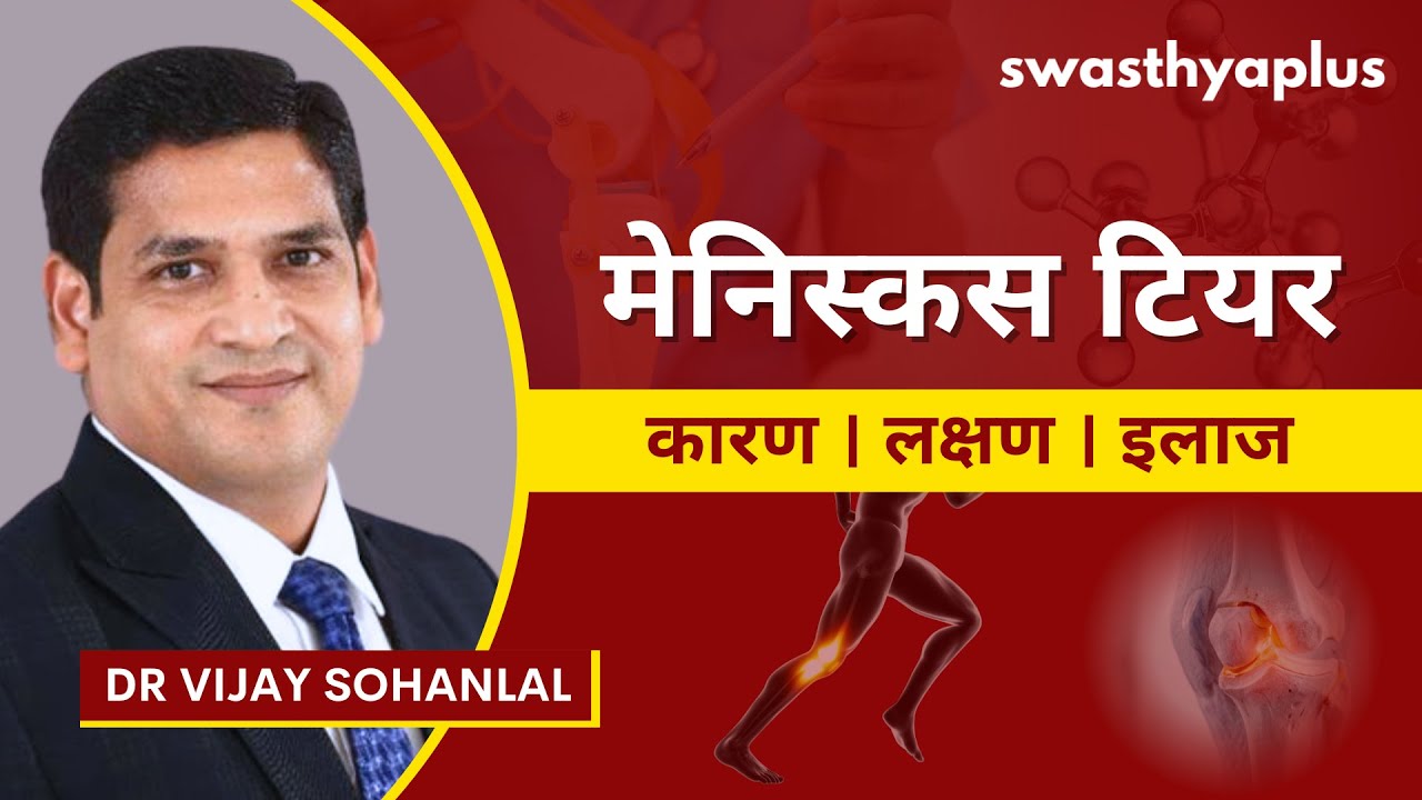 मेनिस्कस का फटना क्या है? | What is Meniscus Tear? in Hindi | Knee Pain | Dr Vijay Sohanlal