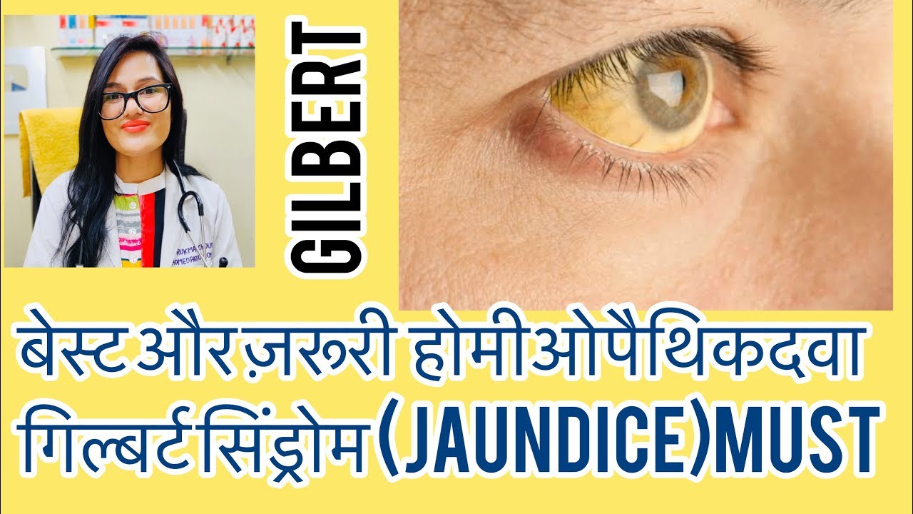 गिल्बर्ट सिंड्रोम?Gilbert syndrome Best Homeopathic Medicine?Jaundice Treatment |पिलीआँख-Dr.rukmani