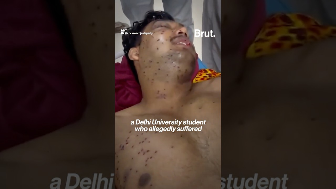 Can dissent be met with pellet guns?