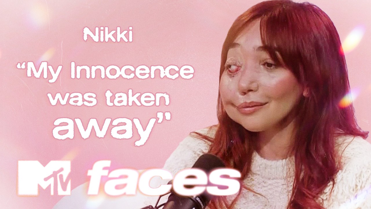 “I Still Get Stared At”: Nikki Lilly on Abusive Comments & Facial Differences | Faces: Body Image