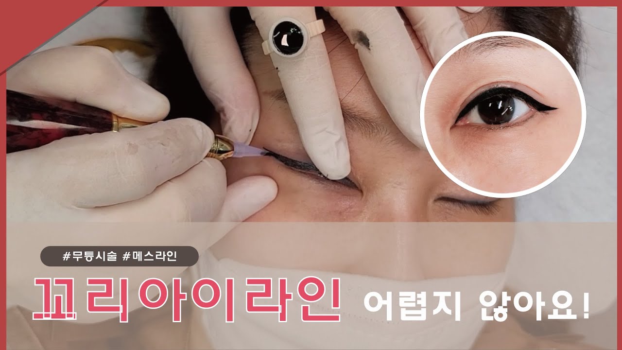 세이지뷰티의 핫한 메스라인 시술 과정 전격공개! 무통 뒷트임 꼬리아이라인