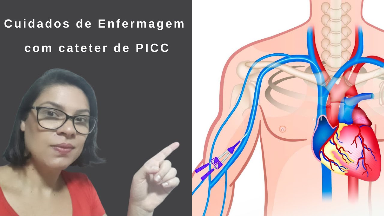 PICC - Cuidados de Enfermagem