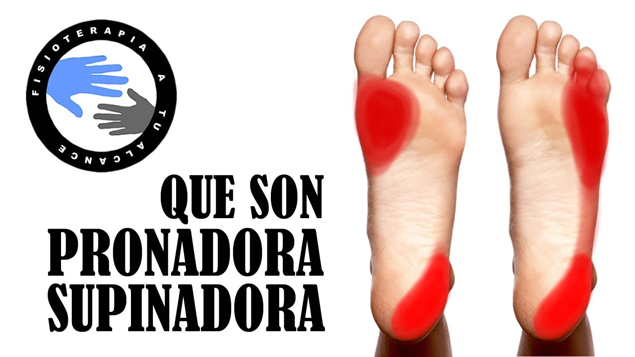 Pisada pronadora o supinadora, que significan
