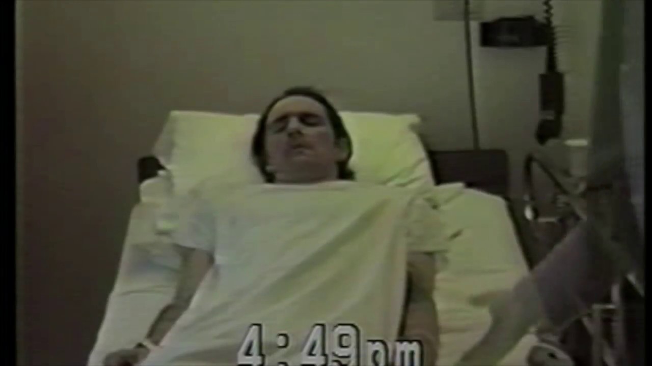 MPTP-induced parkinsonism: Patient 3
