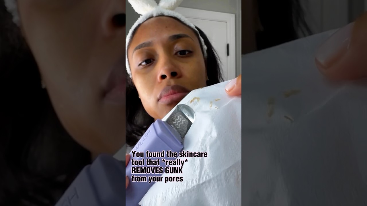 🚨Clogged pores are a selfie disaster waiting to happen! Shop #dermapore to really deep clean pores